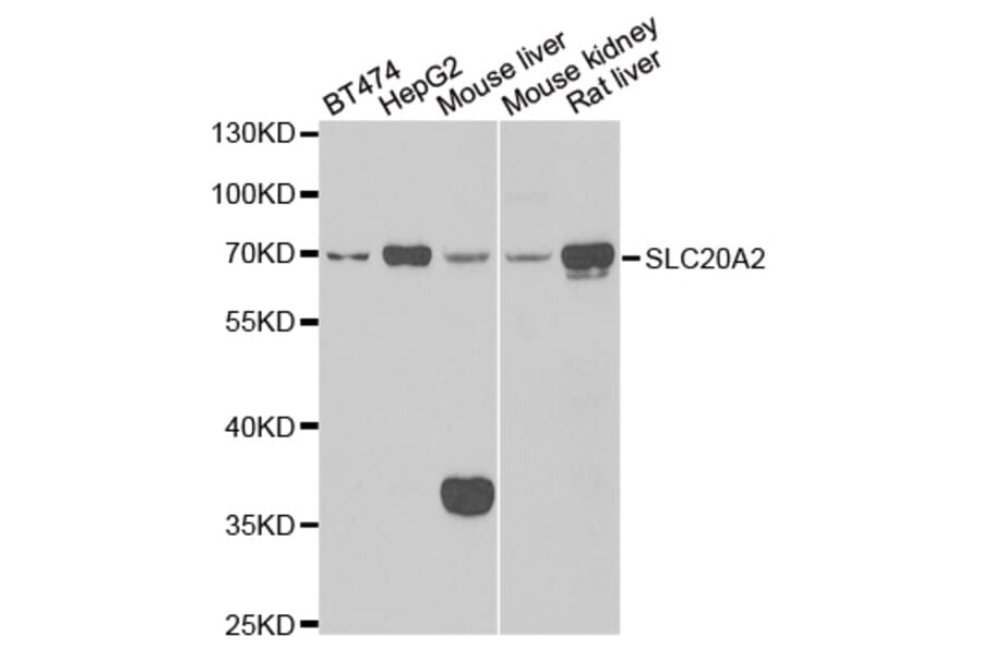 Western blot - SLC20A2 antibody from Signalway Antibody (39144) - Antibodies.com