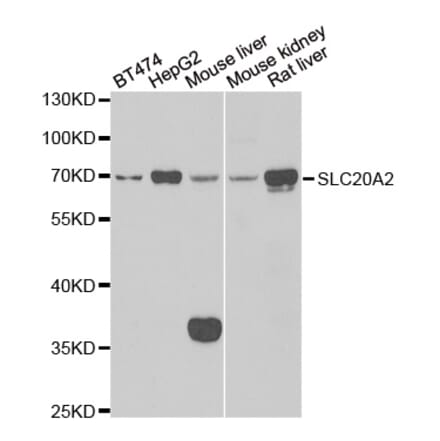 Western blot - SLC20A2 antibody from Signalway Antibody (39144) - Antibodies.com