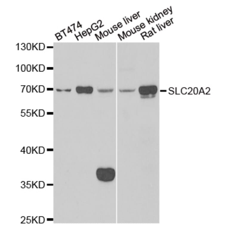 Western blot - SLC20A2 antibody from Signalway Antibody (39144) - Antibodies.com