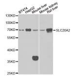 Western blot - SLC20A2 antibody from Signalway Antibody (39144) - Antibodies.com