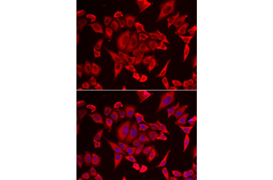 Immunofluorescence - SLC20A2 antibody from Signalway Antibody (39144) - Antibodies.com