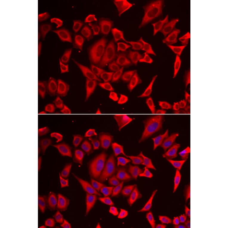 Immunofluorescence - SLC20A2 antibody from Signalway Antibody (39144) - Antibodies.com