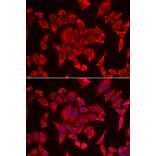 Immunofluorescence - SLC20A2 antibody from Signalway Antibody (39144) - Antibodies.com