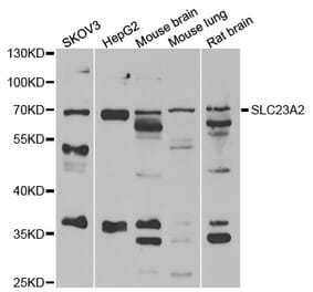 Western blot - SLC23A2 antibody from Signalway Antibody (39145) - Antibodies.com