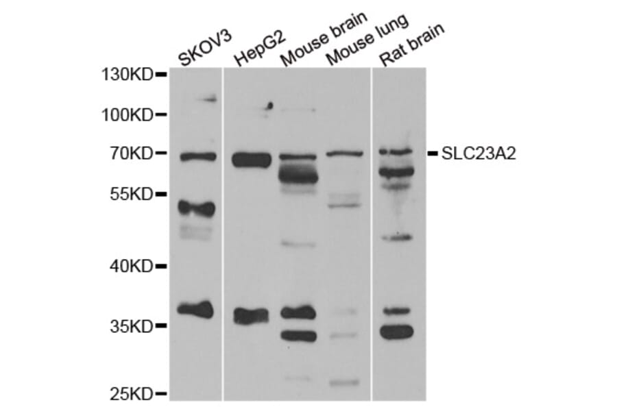 Western blot - SLC23A2 antibody from Signalway Antibody (39145) - Antibodies.com