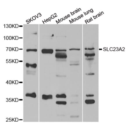 Western blot - SLC23A2 antibody from Signalway Antibody (39145) - Antibodies.com