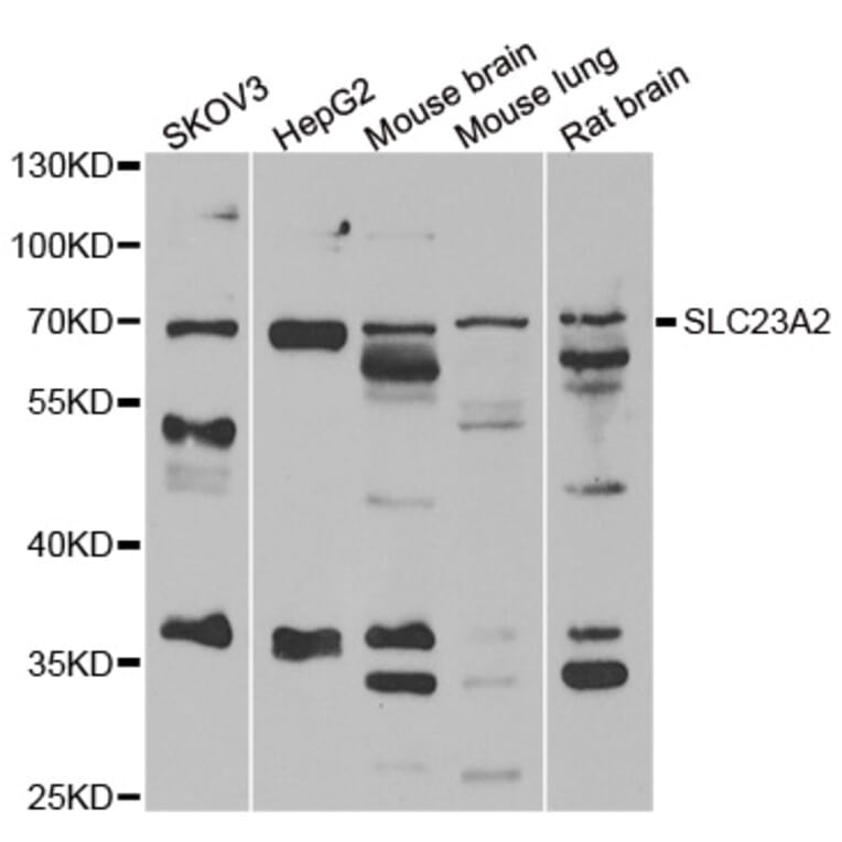 Western blot - SLC23A2 antibody from Signalway Antibody (39145) - Antibodies.com