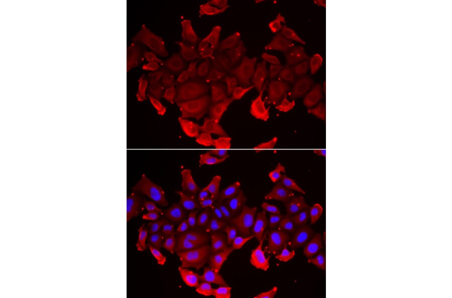 Immunofluorescence - SLC23A2 antibody from Signalway Antibody (39145) - Antibodies.com