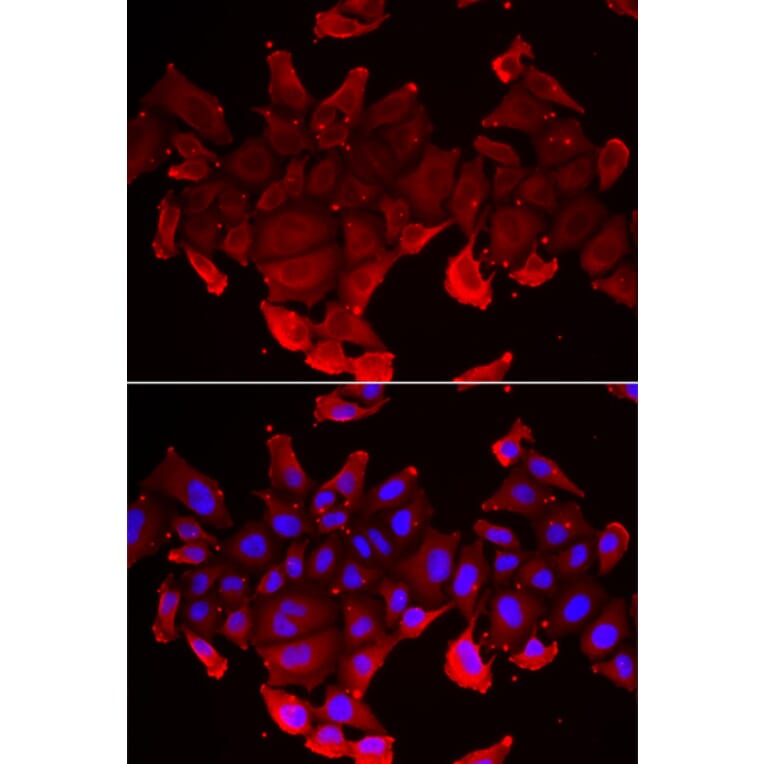 Immunofluorescence - SLC23A2 antibody from Signalway Antibody (39145) - Antibodies.com