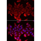 Immunofluorescence - SLC23A2 antibody from Signalway Antibody (39145) - Antibodies.com