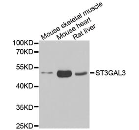 Western blot - ST3GAL3 antibody from Signalway Antibody (39153) - Antibodies.com