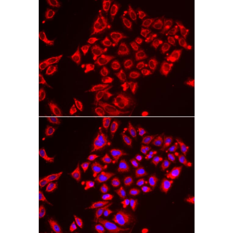 Immunofluorescence - ST3GAL3 antibody from Signalway Antibody (39153) - Antibodies.com