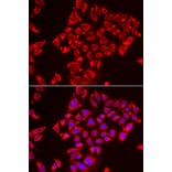 Immunofluorescence - ST3GAL3 antibody from Signalway Antibody (39153) - Antibodies.com