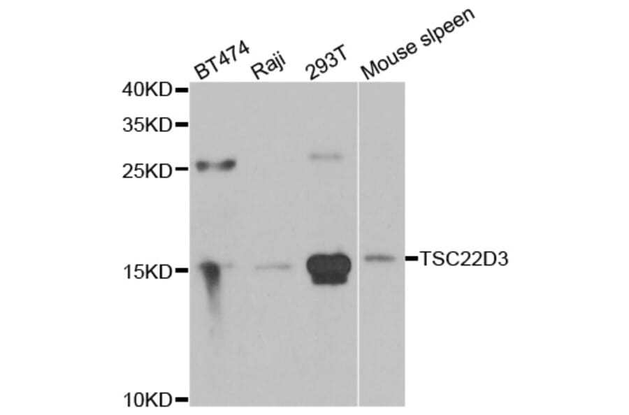 Western blot - TSC22D3 antibody from Signalway Antibody (39175) - Antibodies.com