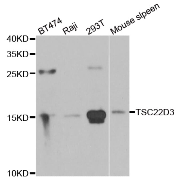 Western blot - TSC22D3 antibody from Signalway Antibody (39175) - Antibodies.com