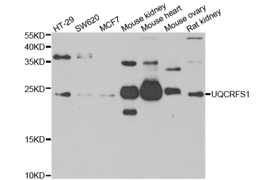 Western blot - UQCRFS1 antibody from Signalway Antibody (39180) - Antibodies.com