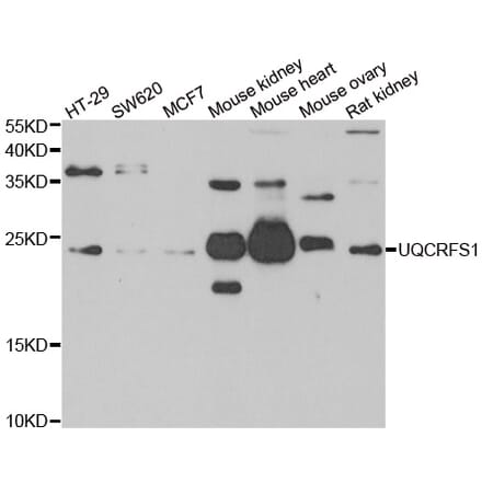 Western blot - UQCRFS1 antibody from Signalway Antibody (39180) - Antibodies.com