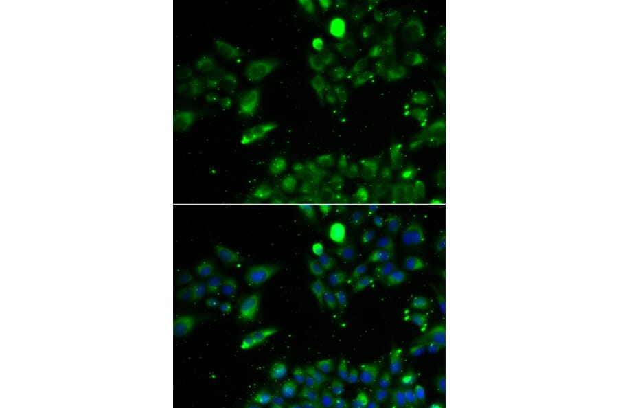 Immunofluorescence - UQCRFS1 antibody from Signalway Antibody (39180) - Antibodies.com