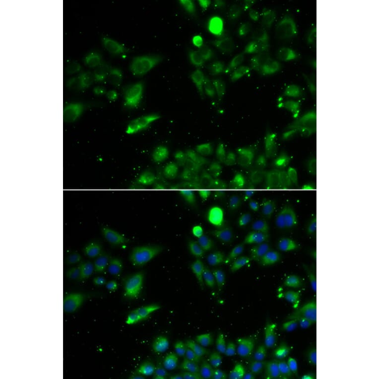 Immunofluorescence - UQCRFS1 antibody from Signalway Antibody (39180) - Antibodies.com