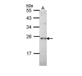 calcium binding protein P22 antibody from Signalway Antibody (22263) - Antibodies.com