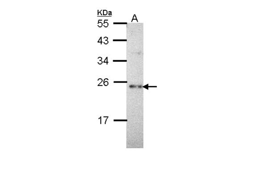 calcium binding protein P22 antibody from Signalway Antibody (22263) - Antibodies.com