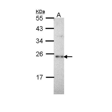 calcium binding protein P22 antibody from Signalway Antibody (22263) - Antibodies.com