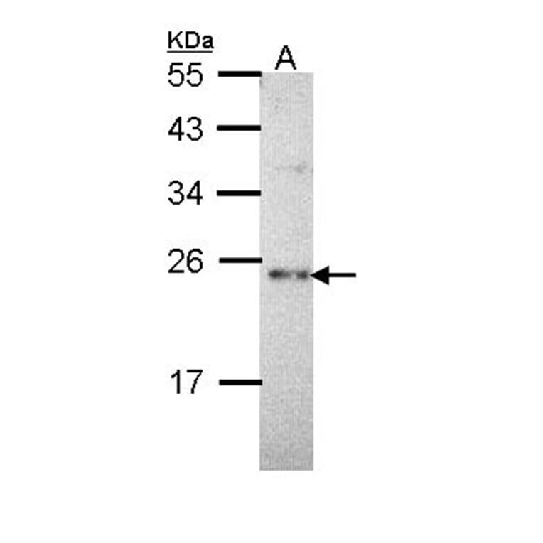 calcium binding protein P22 antibody from Signalway Antibody (22263) - Antibodies.com