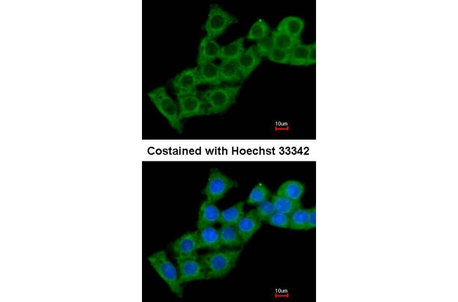 Immunofluorescence - calcium binding protein P22 antibody from Signalway Antibody (22263) - Antibodies.com