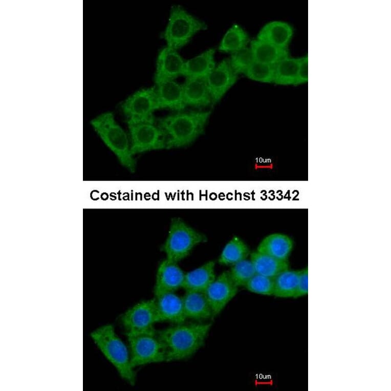 Immunofluorescence - calcium binding protein P22 antibody from Signalway Antibody (22263) - Antibodies.com