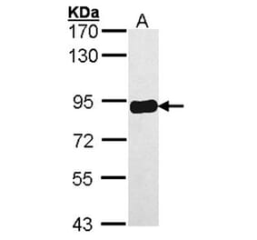 PRKCSH antibody from Signalway Antibody (22041) - Antibodies.com