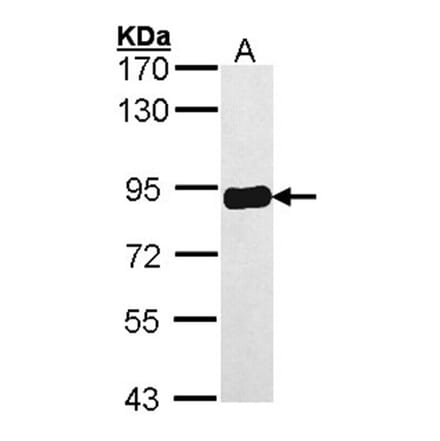 PRKCSH antibody from Signalway Antibody (22041) - Antibodies.com
