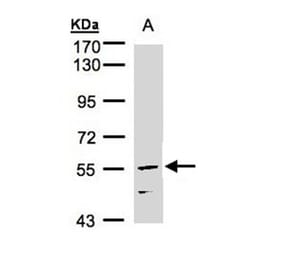 CDCA1 antibody from Signalway Antibody (22108) - Antibodies.com