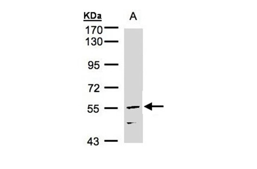 CDCA1 antibody from Signalway Antibody (22108) - Antibodies.com