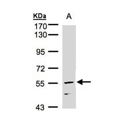 CDCA1 antibody from Signalway Antibody (22108) - Antibodies.com