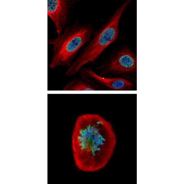 CDCA1 antibody from Signalway Antibody (22108) - Antibodies.com