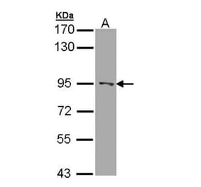 RASAL1 antibody from Signalway Antibody (22120) - Antibodies.com