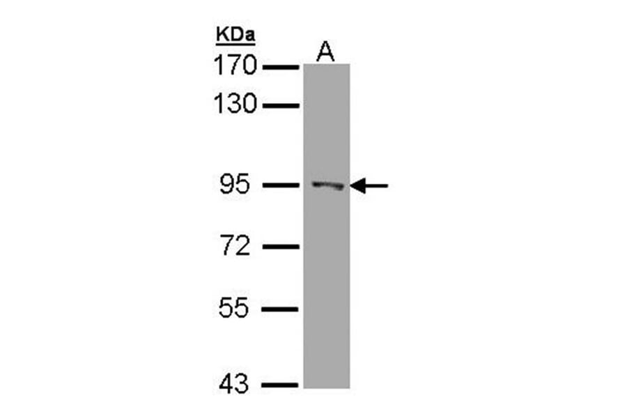 RASAL1 antibody from Signalway Antibody (22120) - Antibodies.com