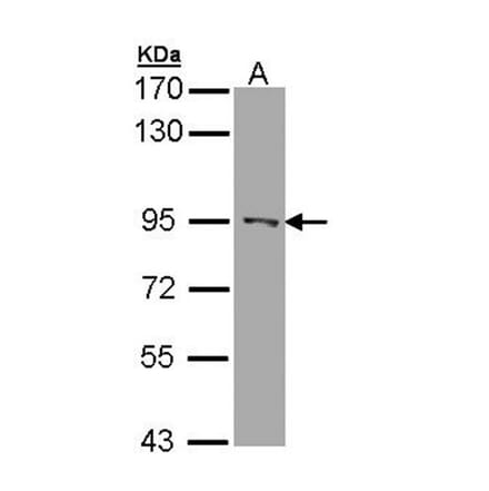 RASAL1 antibody from Signalway Antibody (22120) - Antibodies.com