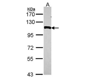 NPEPPS antibody from Signalway Antibody (22131) - Antibodies.com