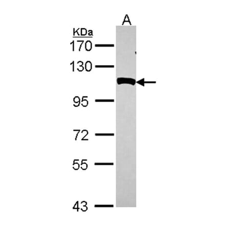 NPEPPS antibody from Signalway Antibody (22131) - Antibodies.com