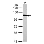 NPEPPS antibody from Signalway Antibody (22131) - Antibodies.com