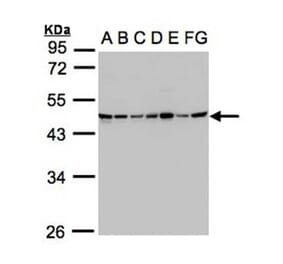 SUCLG2 antibody from Signalway Antibody (22171) - Antibodies.com