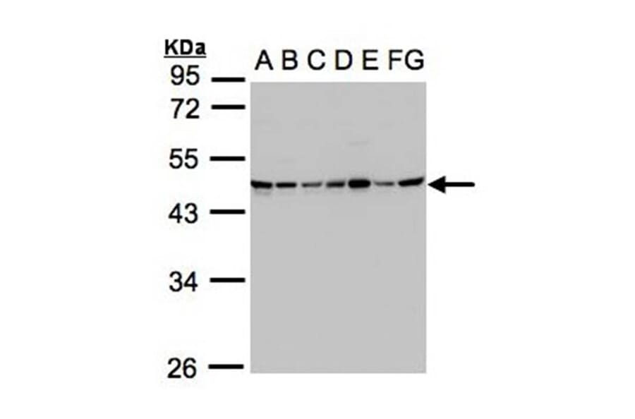 SUCLG2 antibody from Signalway Antibody (22171) - Antibodies.com