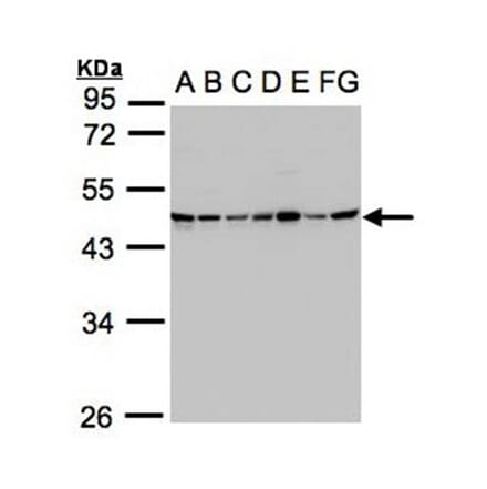 SUCLG2 antibody from Signalway Antibody (22171) - Antibodies.com
