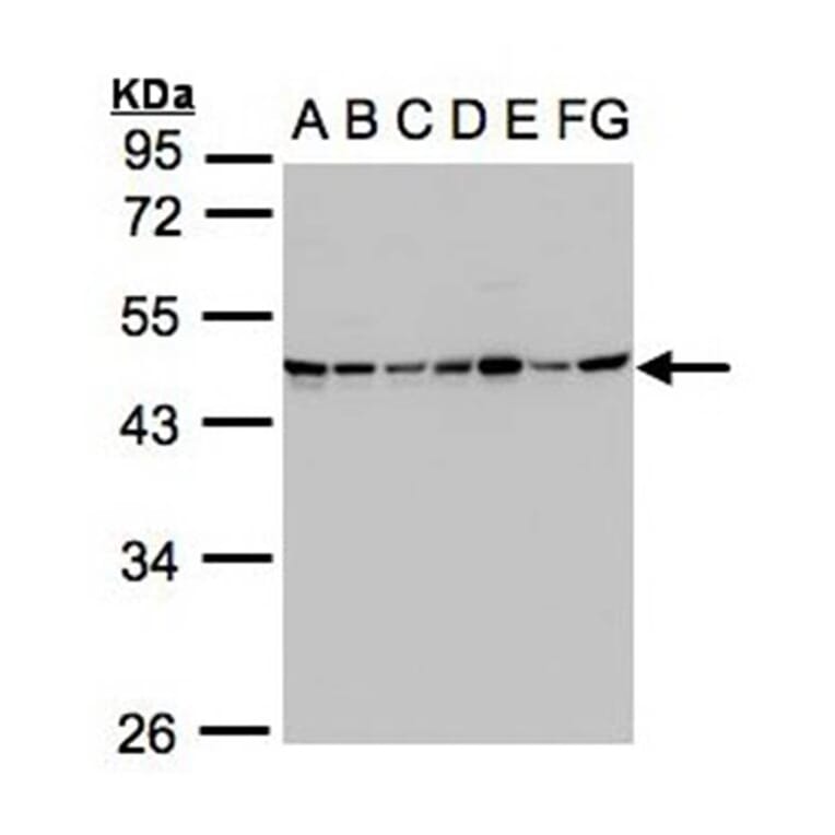 SUCLG2 antibody from Signalway Antibody (22171) - Antibodies.com