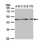 SUCLG2 antibody from Signalway Antibody (22171) - Antibodies.com