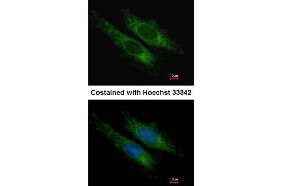 Immunofluorescence - SUCLG2 antibody from Signalway Antibody (22171) - Antibodies.com