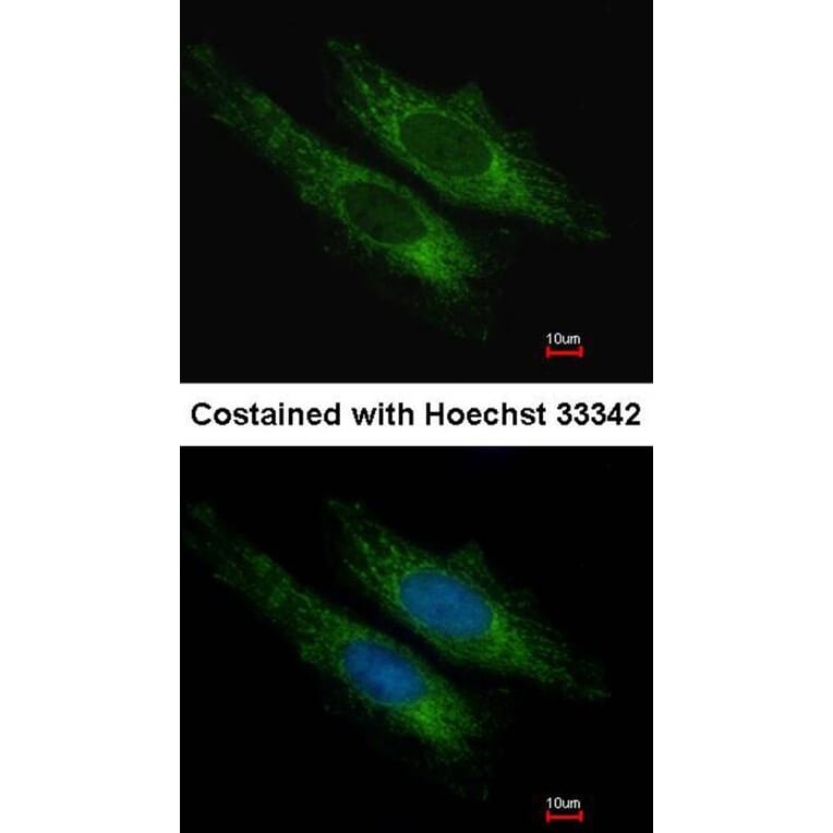 Immunofluorescence - SUCLG2 antibody from Signalway Antibody (22171) - Antibodies.com
