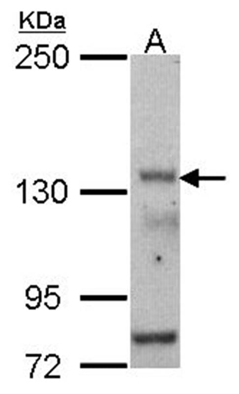 Sample (30 µg of whole cell lysate)  HCT116 5% SDS PAGE Primary antibody diluted at 1: 500