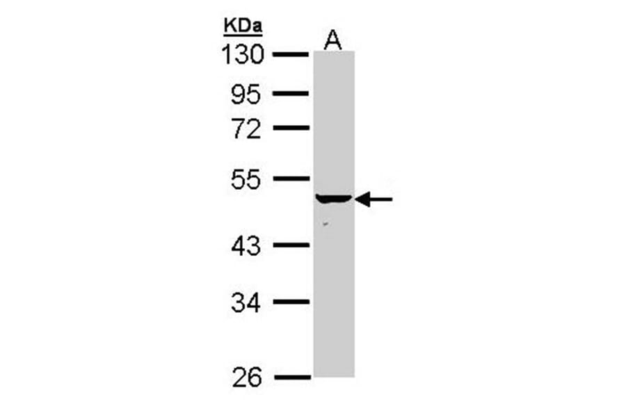 KRTHA4 antibody from Signalway Antibody (22208) - Antibodies.com